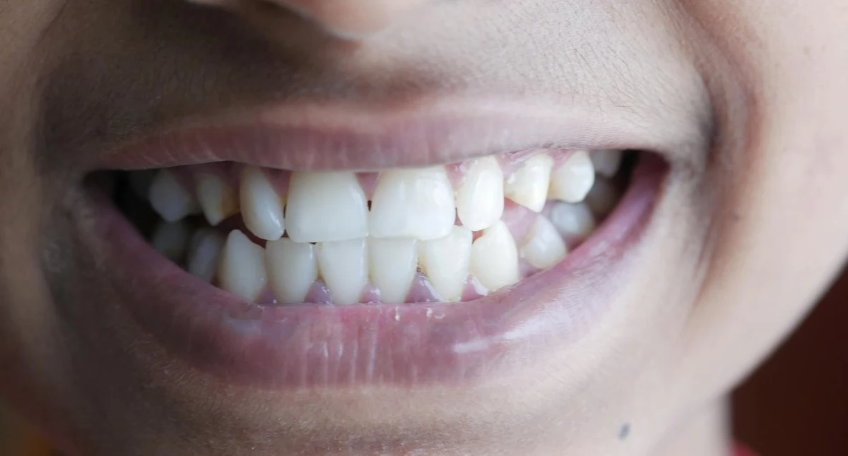 Źródło zdjęcia: Pexels